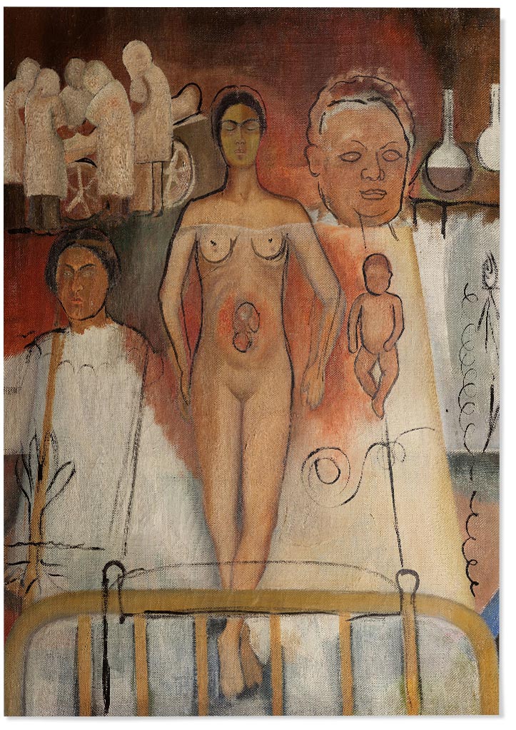 Frida Kahlo Art Print - Frida and the Cesarean