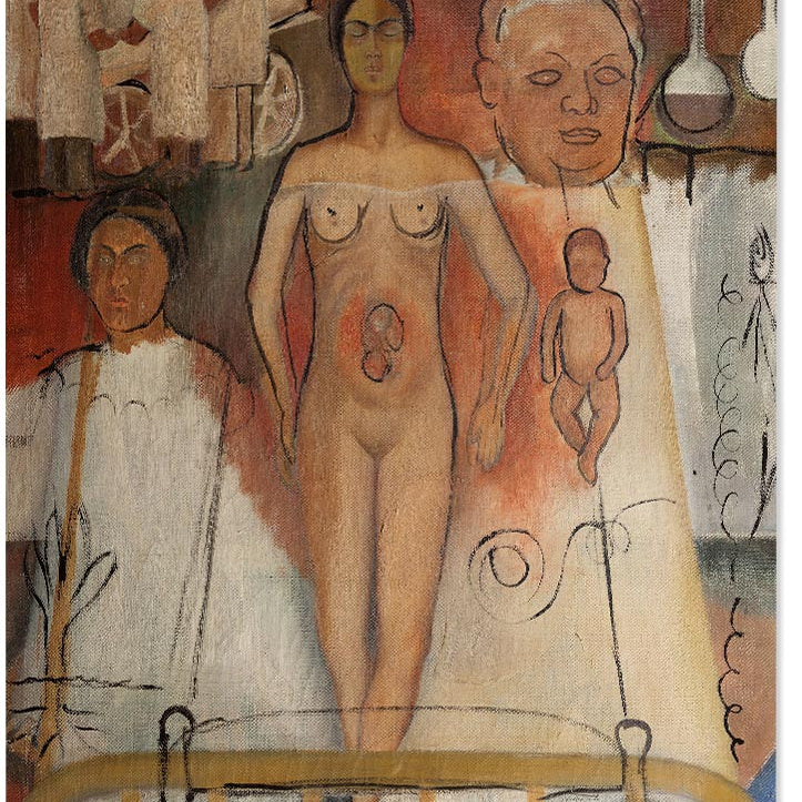 Frida Kahlo Art Print - Frida and the Cesarean
